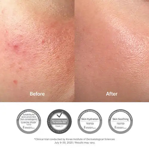 Dr. Althea 345 Relief Acne-Prone Daily Moisturizing Cream 50ml