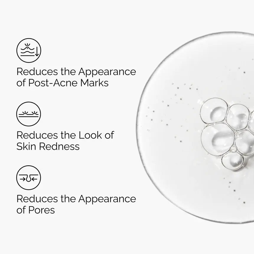 The Ordinary Aloe 2% + NAG 2% Solution for Post-Acne Marks 30ml